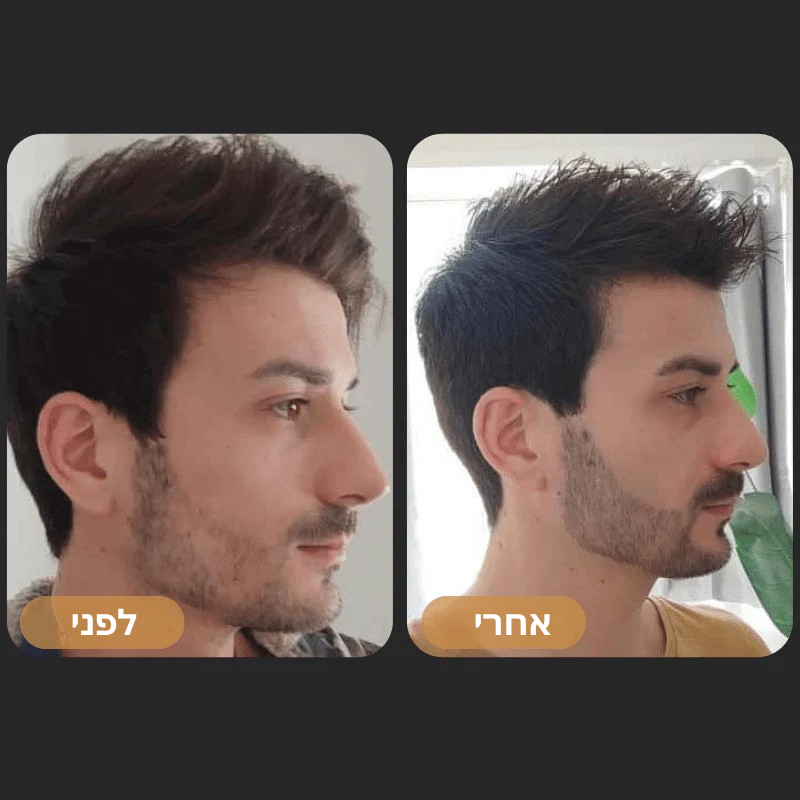 שמן להצמחת זקן